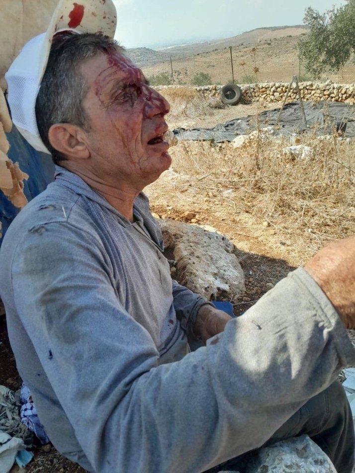 Terrorist Israel attacked Palestinian farmer